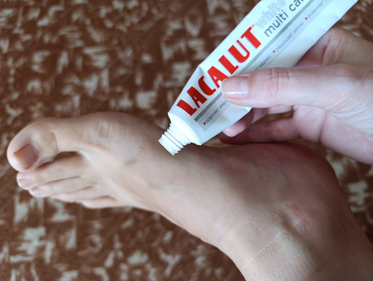 Зубная паста как секрет красоты: неожиданные способы применения для ног