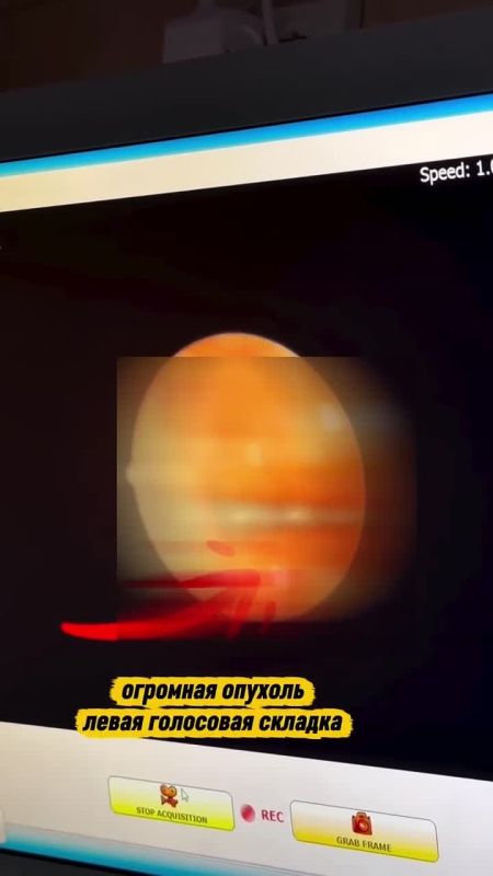 ������� ���� �� ������� ������ ��-�� ����������� ������� � � ��� ����� ������������ �������� �������